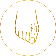 Candidates for Bunion Surgery: Toe Misalignment