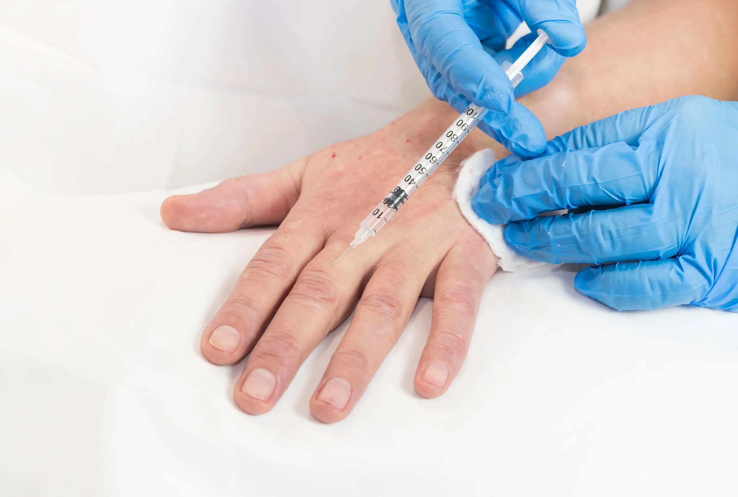 Provider in blue gloves measuring hand with syringe for injectable treatment