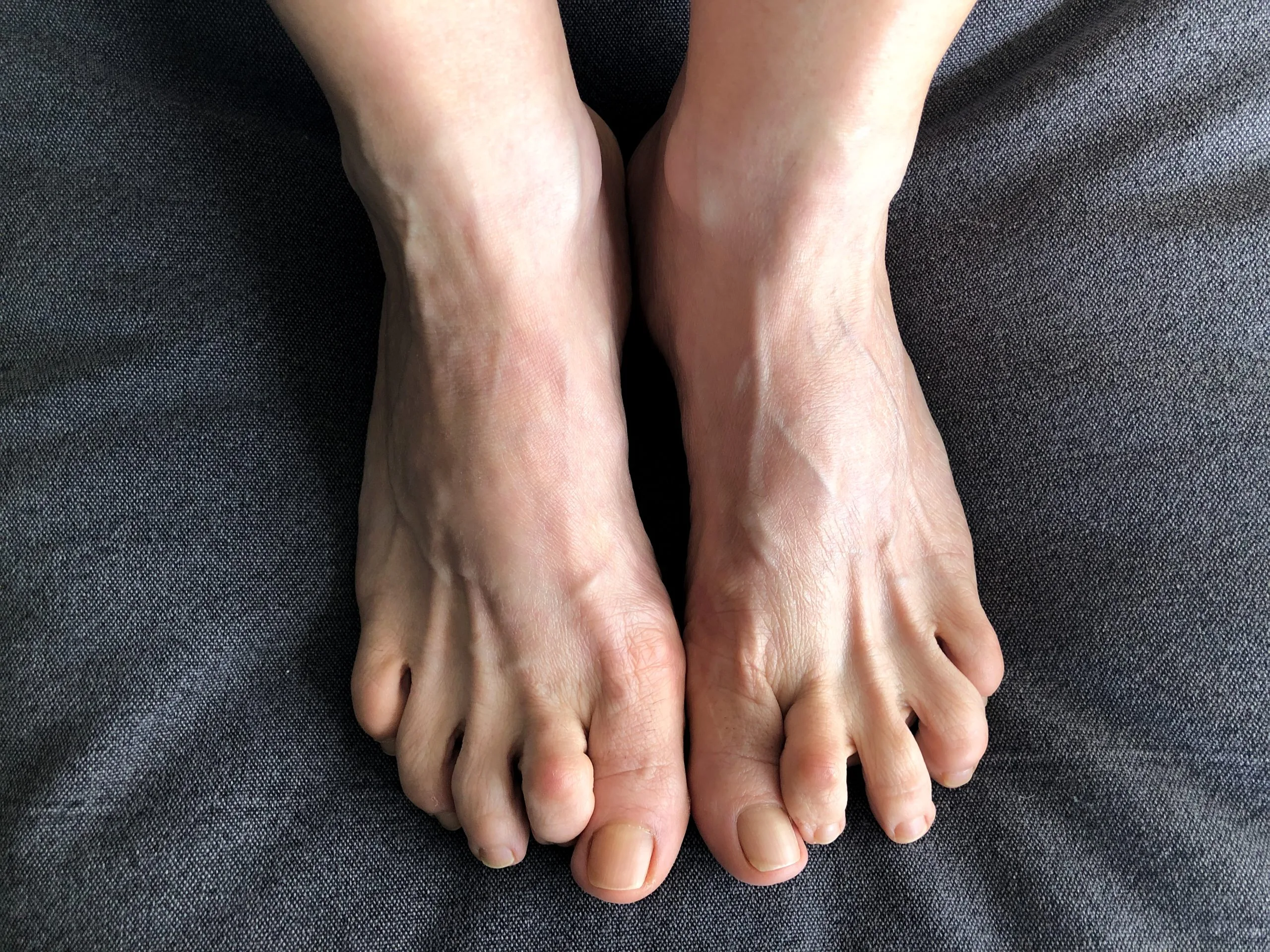 Two bare feet resting on dark fabric, showing natural nails and skin