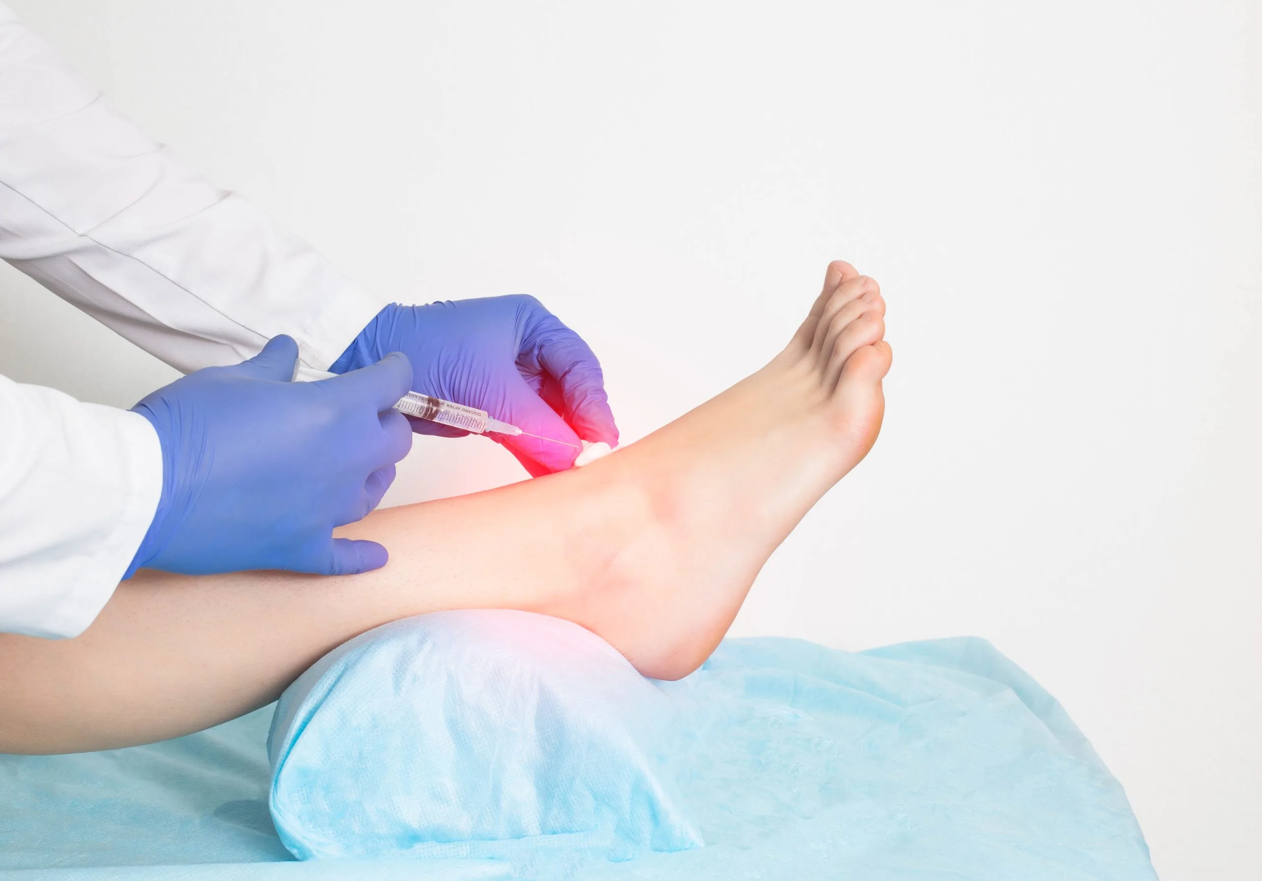 Doctor in blue gloves administering an injection to a patient's foot with red heat indicator