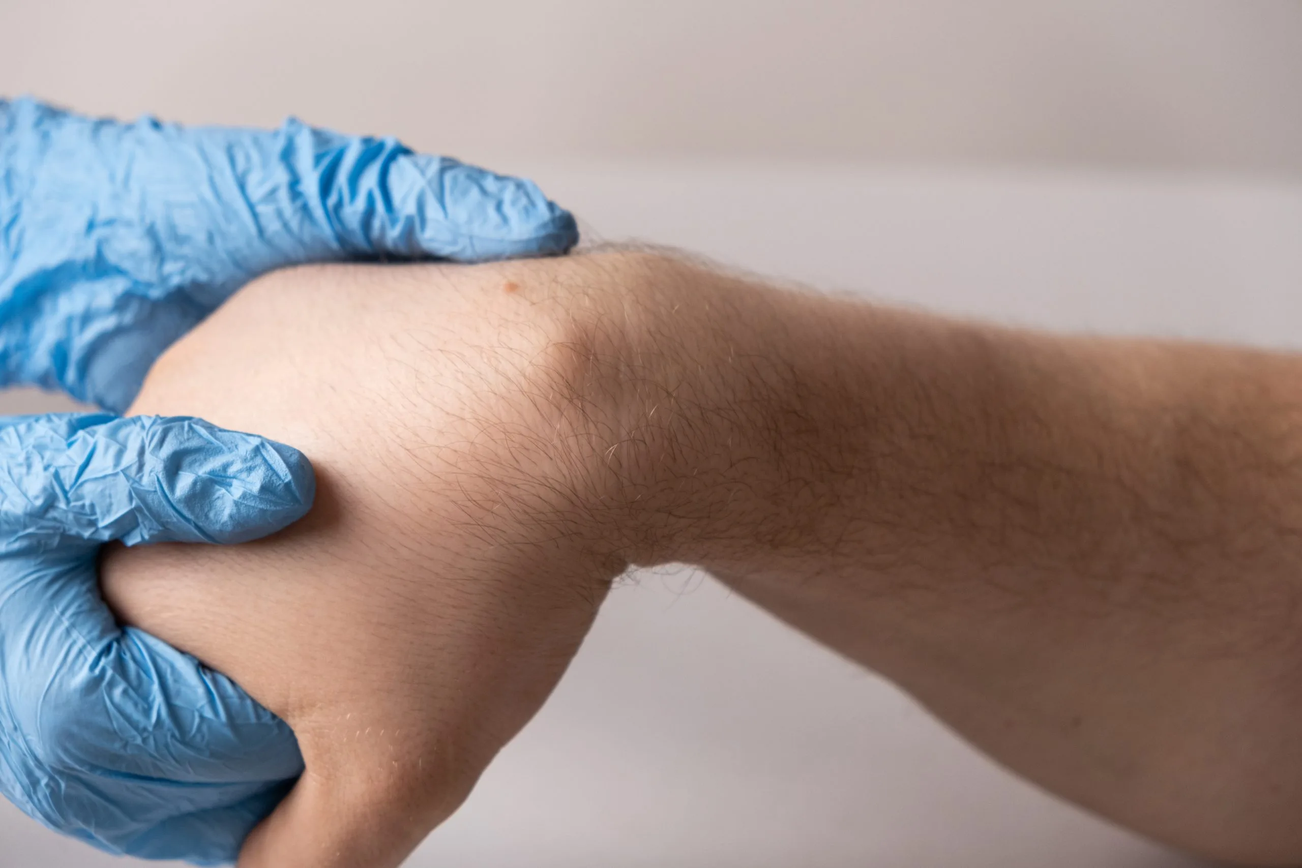 Provider wearing blue gloves examining patient's knee or joint area