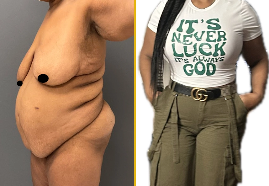 Before and After Gallery: Skin Tightening Banner