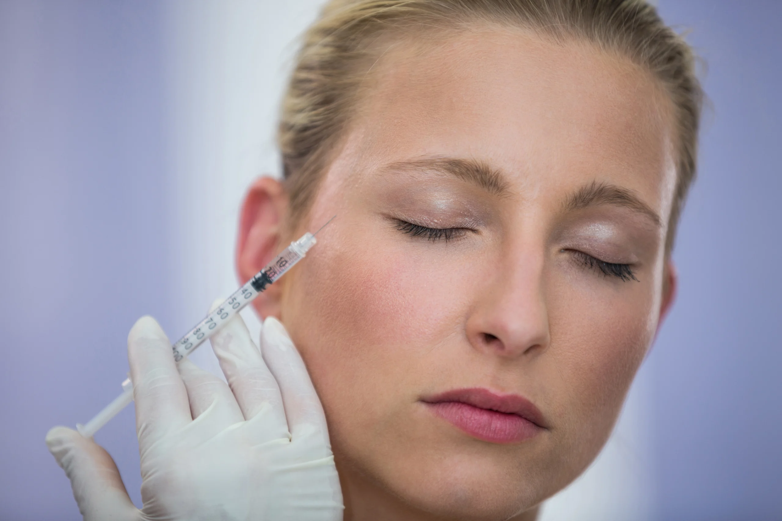 Botox injection near the temple for migraine treatment