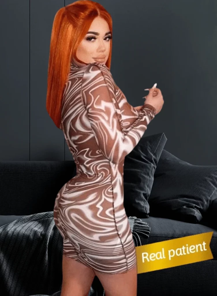 Brazilian Butt Lift Procedure: Step by Step Banner