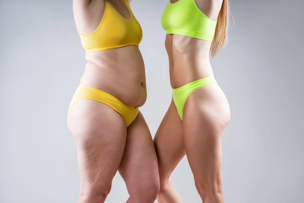 Tummy Tuck vs Mini Tummy Tuck: Which Is Right for You? Banner