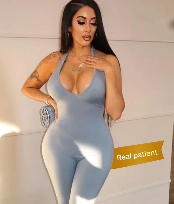 What is a Brazilian Butt Lift? Banner