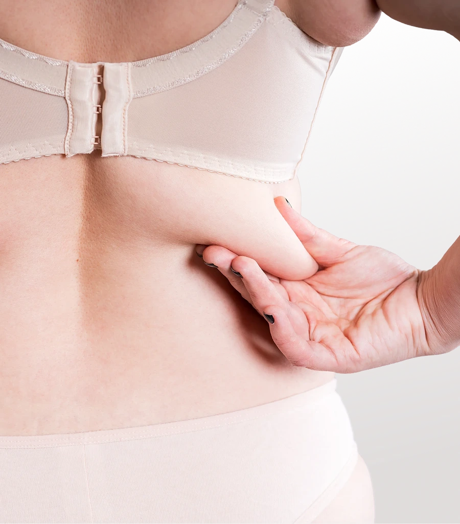 Hand demonstrating skin elasticity on the flank and abdomen area