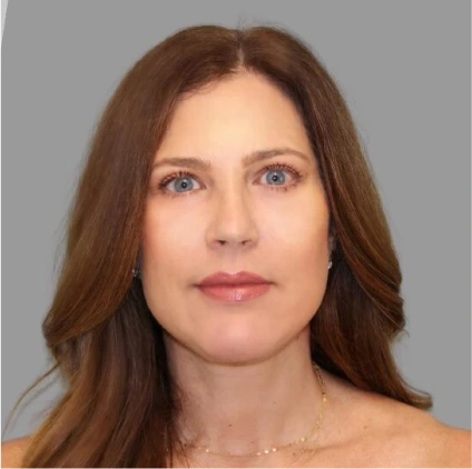 Facelift – Case 4 Before & After Banner