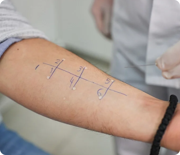 Allergy Testing Services in Houston, TX Banner