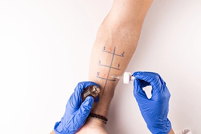 Allergy Testing Skin Test banner