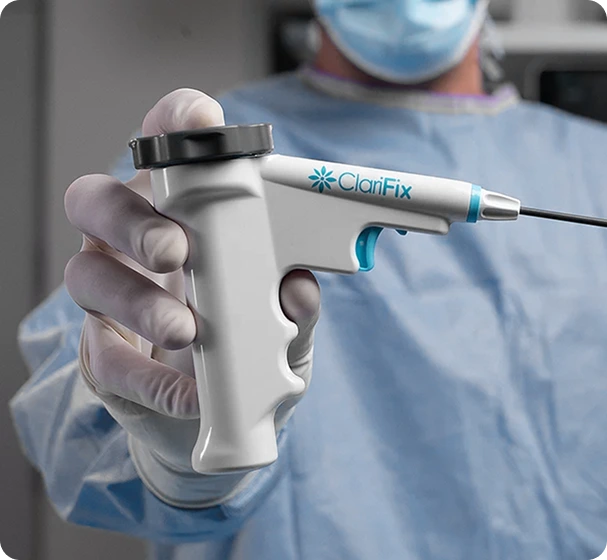 ClariFix Cryotherapy for Chronic Rhinitis Relief