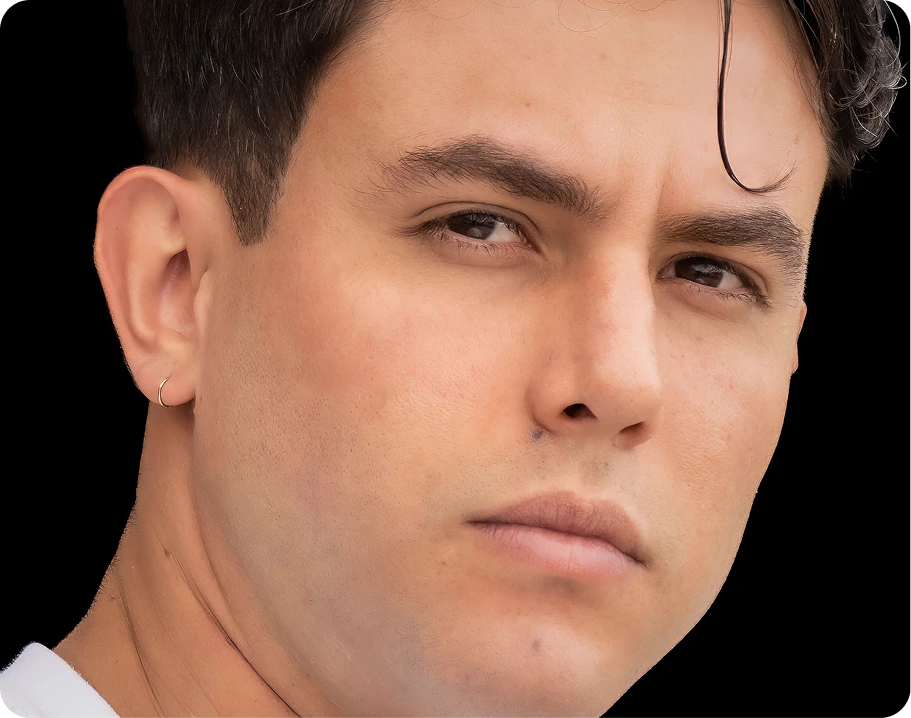 Nasal Valve Reconstruction Houston, TX Banner