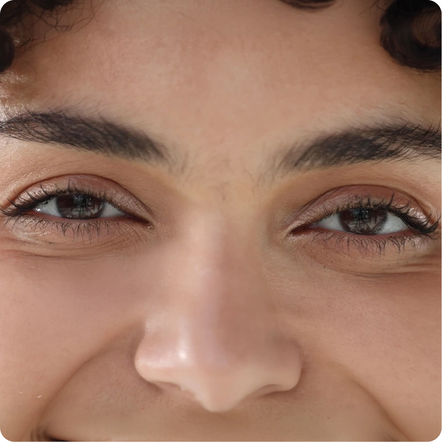 Nasal Valve Reconstruction in Houston, TX Banner