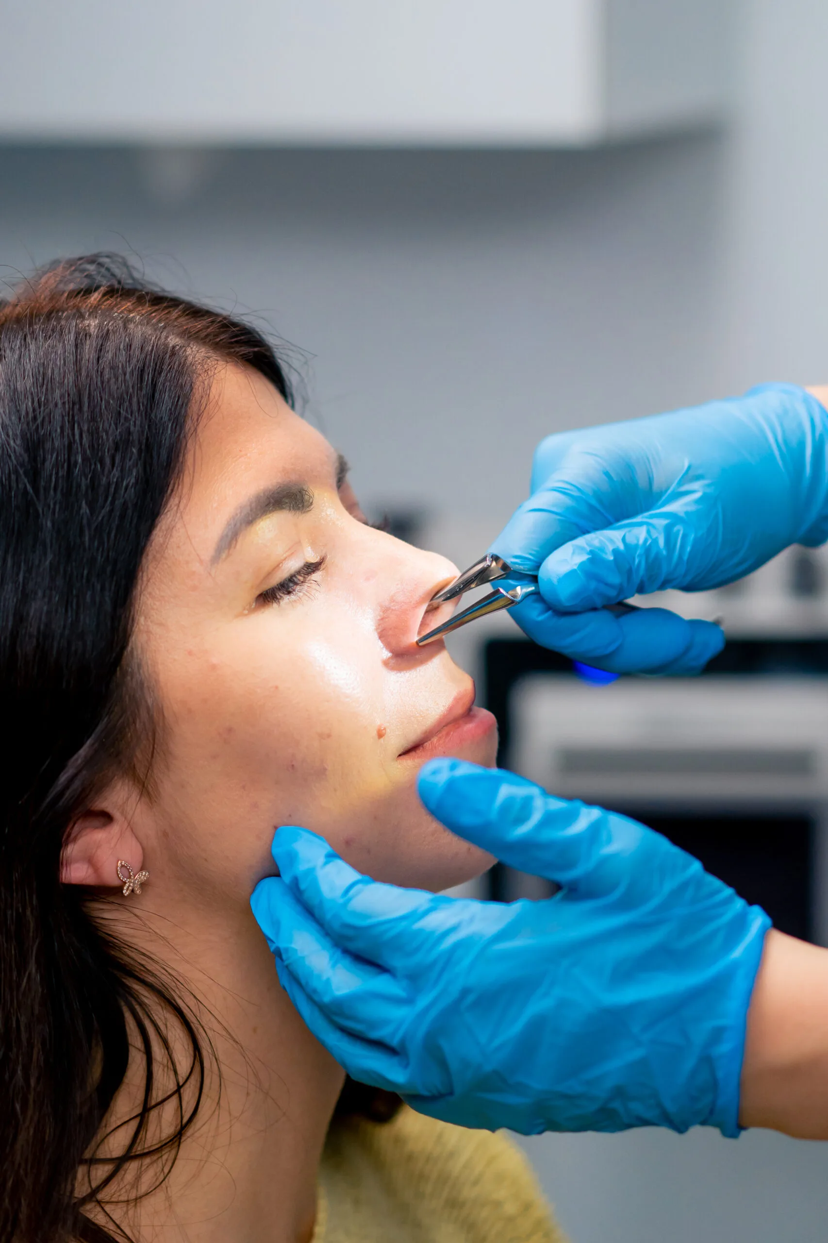 Nose Surgery How Much Does It Cost