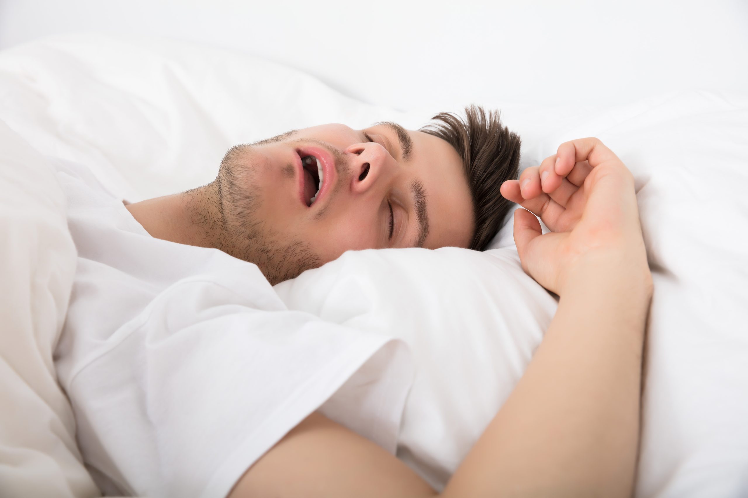 Man snoring while sleeping in bed with white bedding