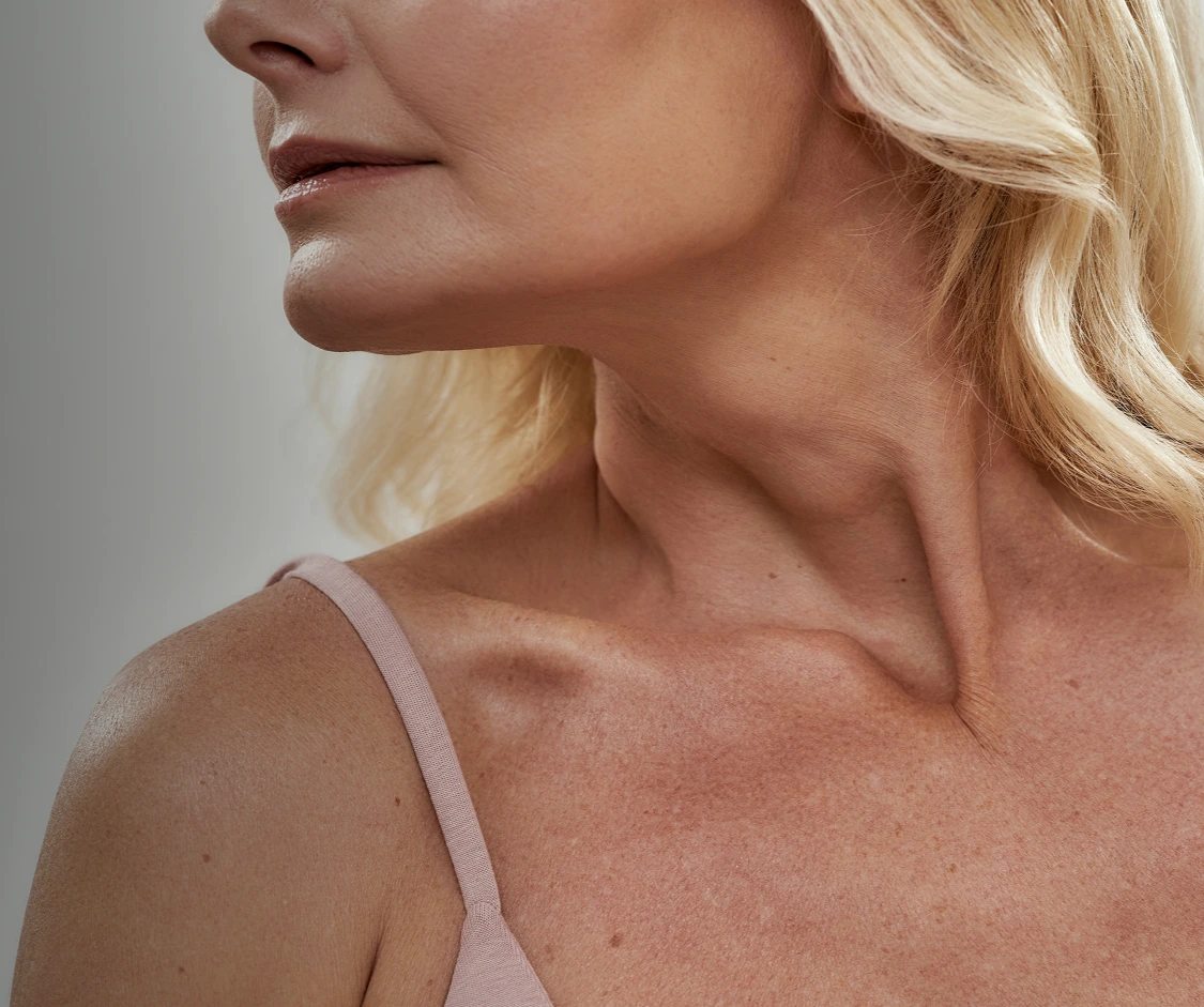 Neck Lift in Scottsdale, AZ Mobile Bg