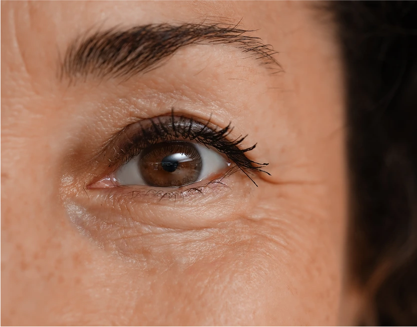 Patient Testimonial Blepharoplasty Scottsdale, AZ Banner