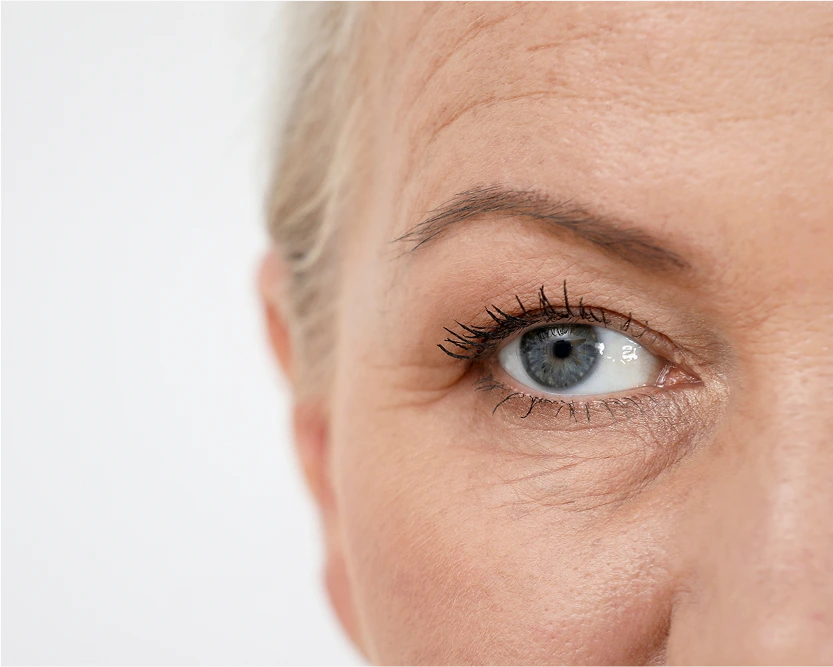 Your Brow Lift Consultation Scottsdale, AZ Banner