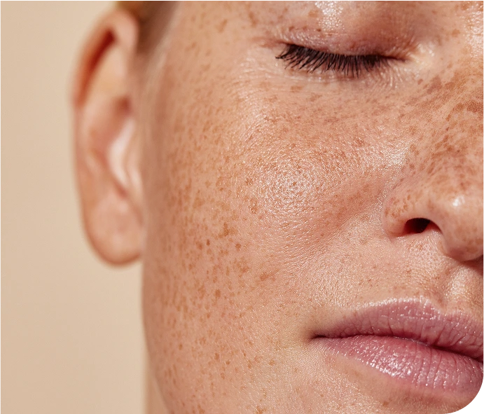 Benefits of Anti-Aging Microneedling Starke FL Banner