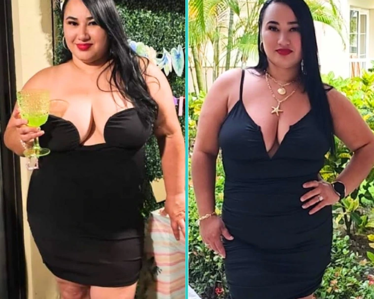 Weight Loss Case 10 Before & After Banner