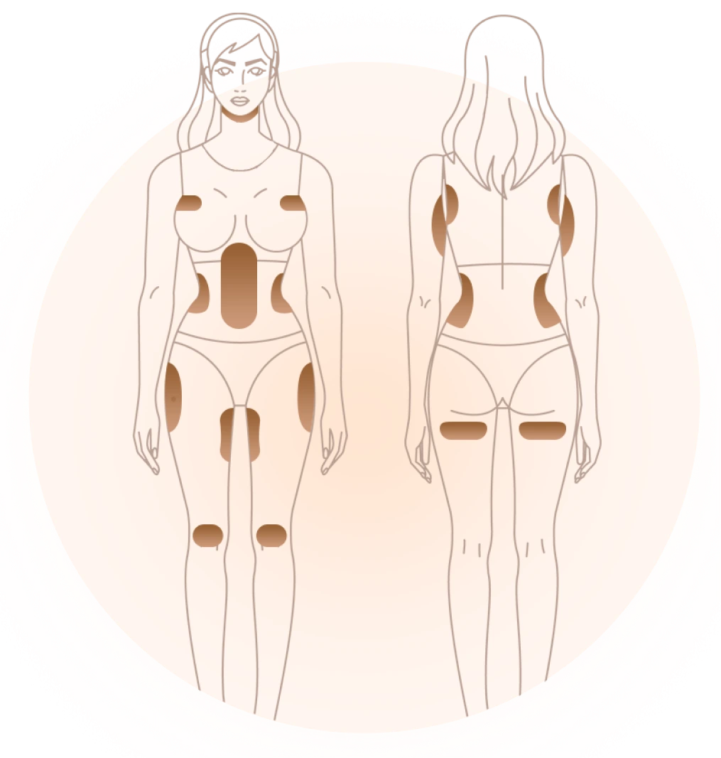 Body Areas Treated Banner