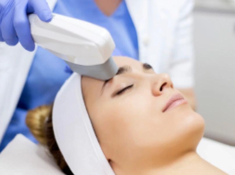 Intense Pulsed Light (IPL) Banner