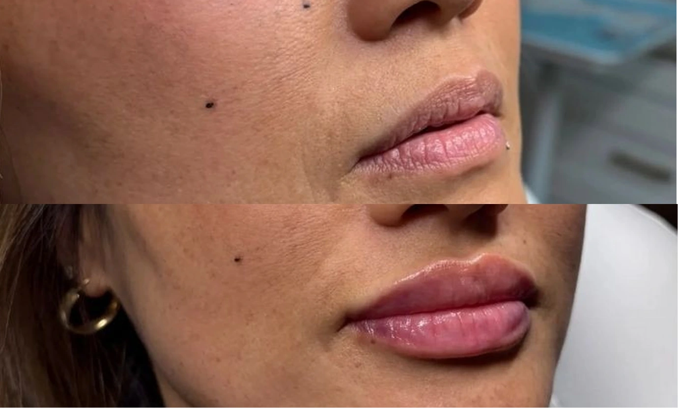 Our Clients Before & After Banner