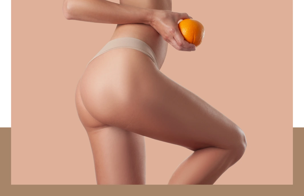 Preparation for Cellulite Treatment Banner