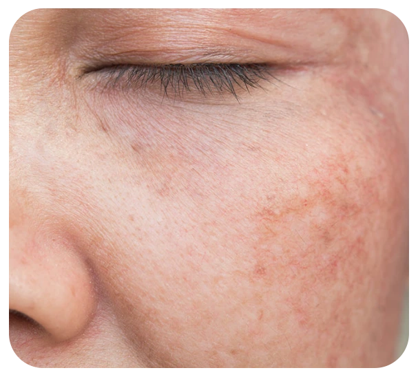 Sun Damage Condition Banner