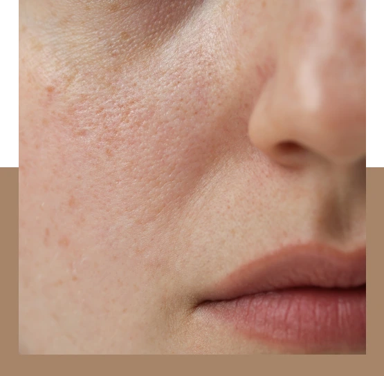 What Is Dull Skin? Banner