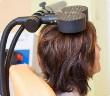 Theta Burst Stimulation (TBS) Banner