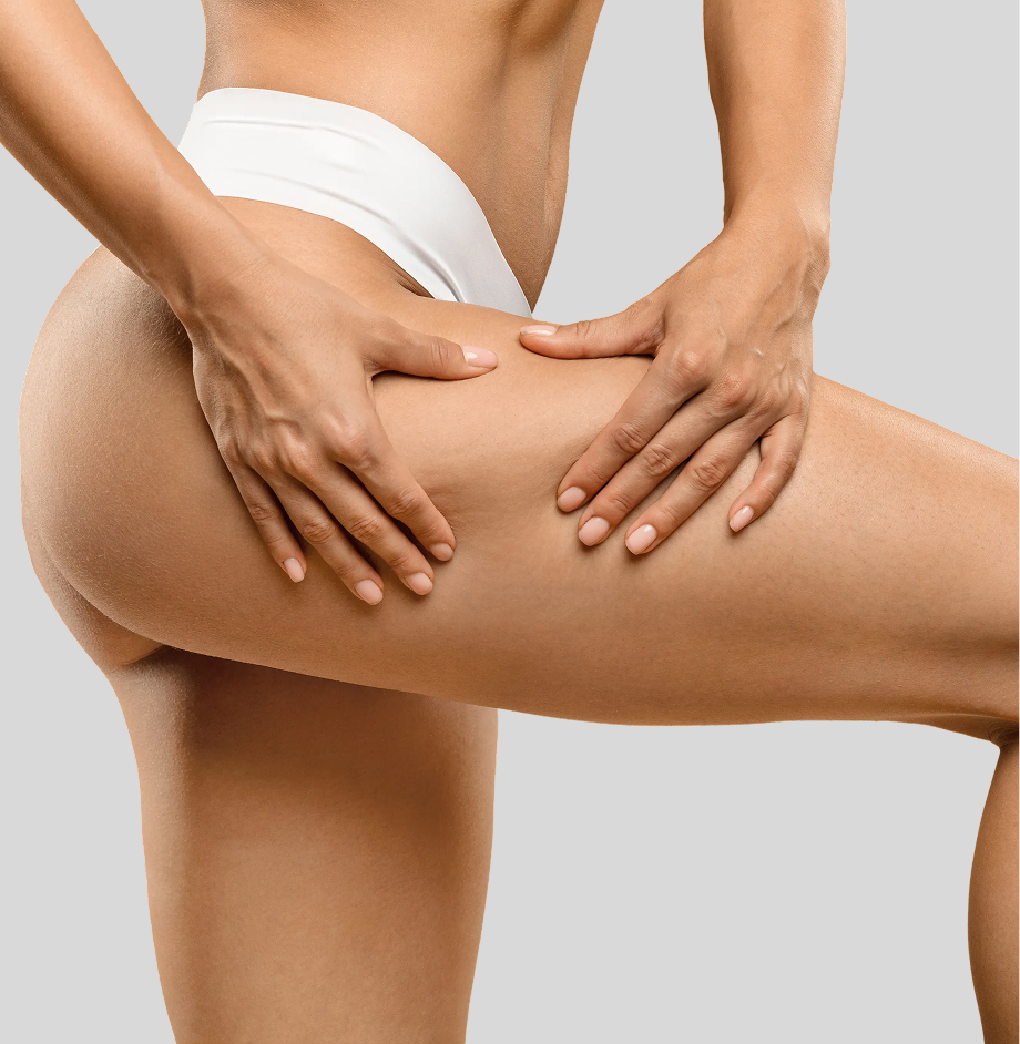Person examining thigh and buttock area for skin texture and cellulite appearance