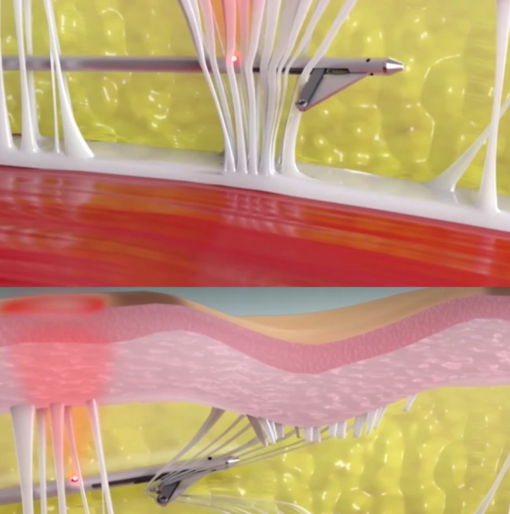 What is Avéli Banner