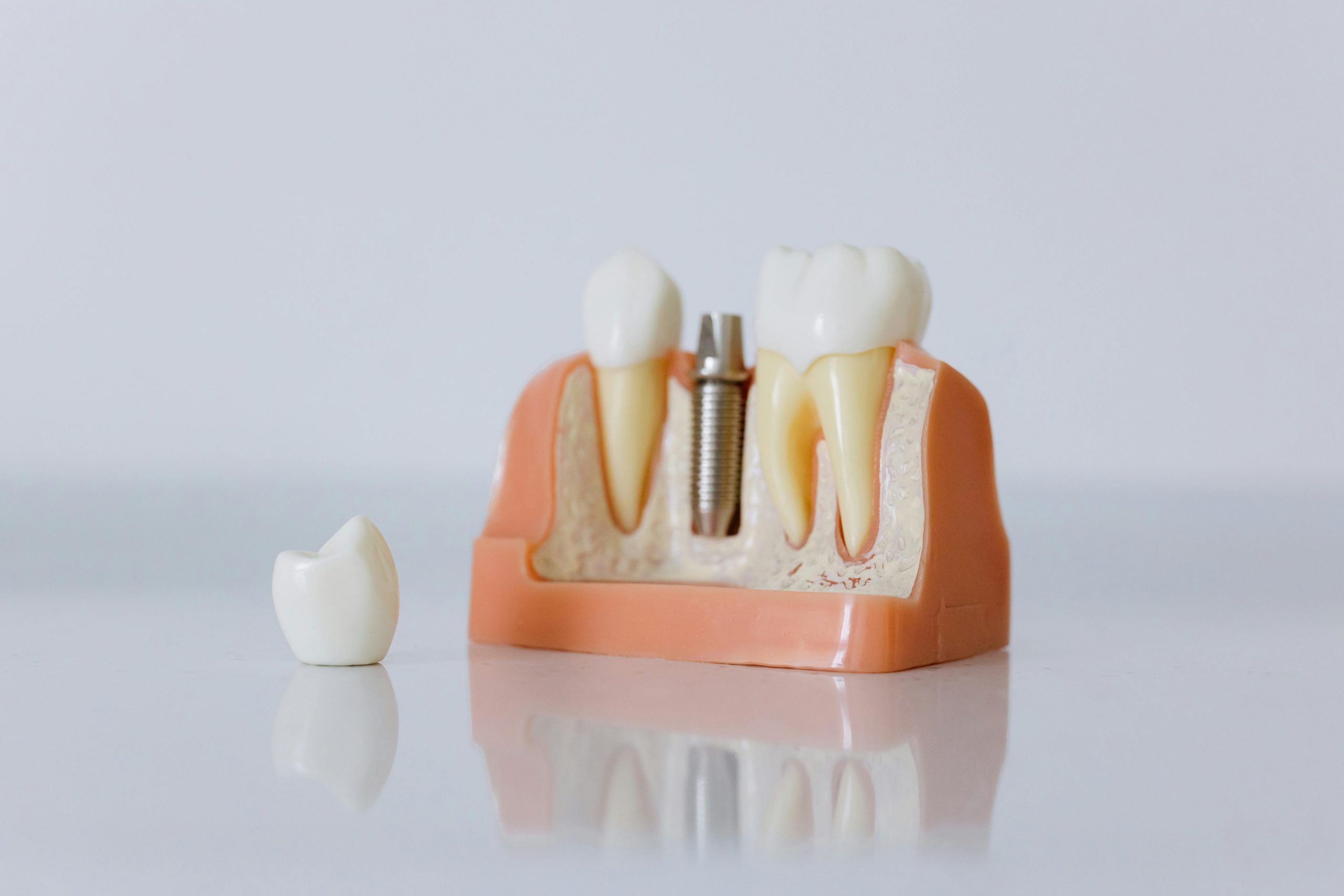 Implant Dentistry vs Dentures: What’s the Difference? Banner