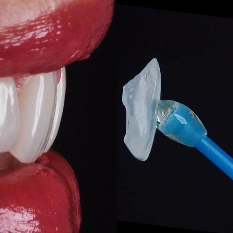 Hand-layered porcelain veneer held beside a patient's smile during a try-in