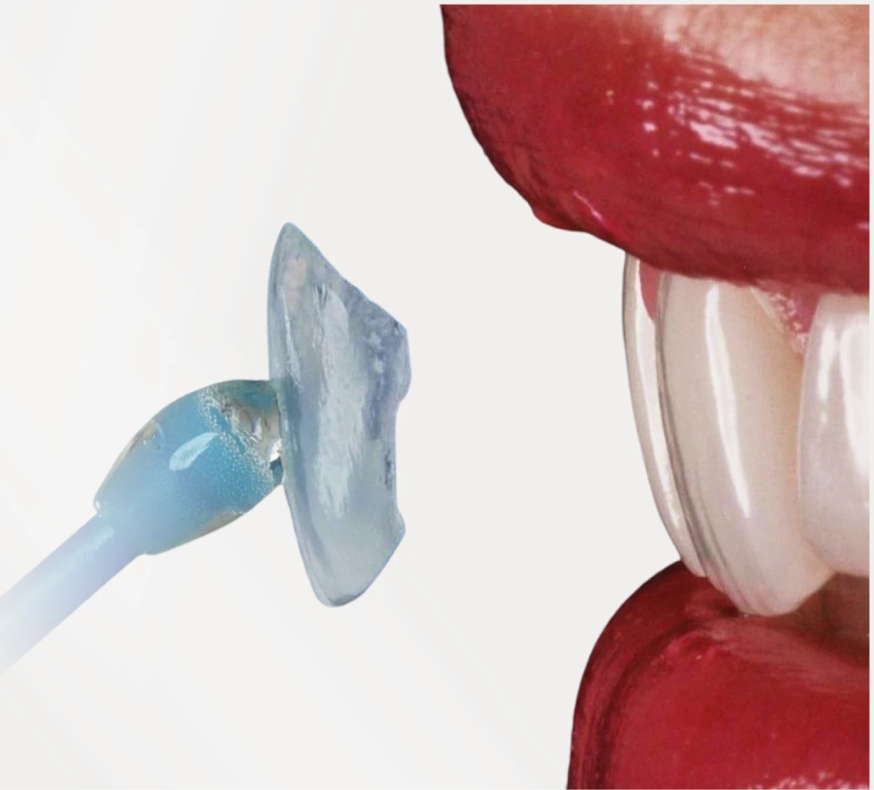 ProClean cleaning tool polishing a porcelain veneer on a front tooth
