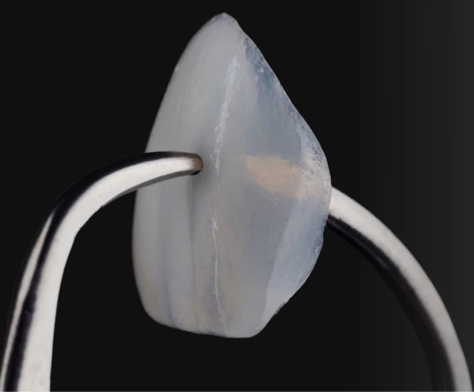 Porcelain veneer held by dental tweezers against black background