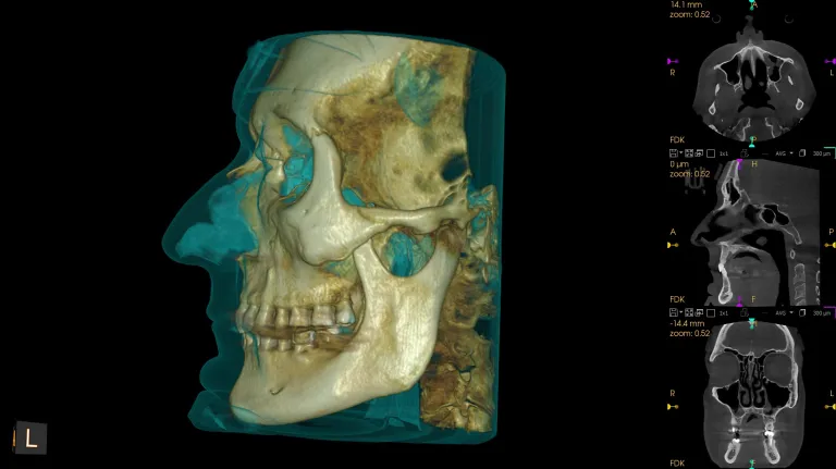Zarrabi CBCT image 1 1