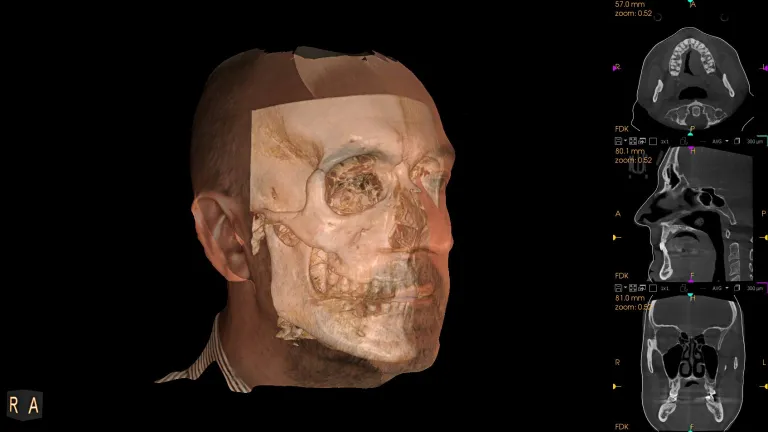 Zarrabi CBCT image 3