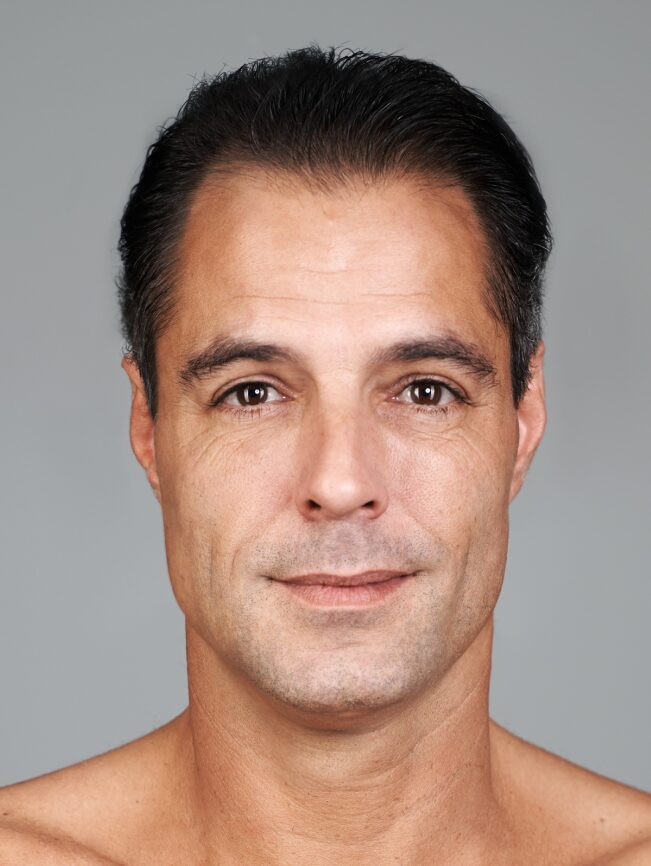 Consultation & Preparation for Functional Rhinoplasty Banner