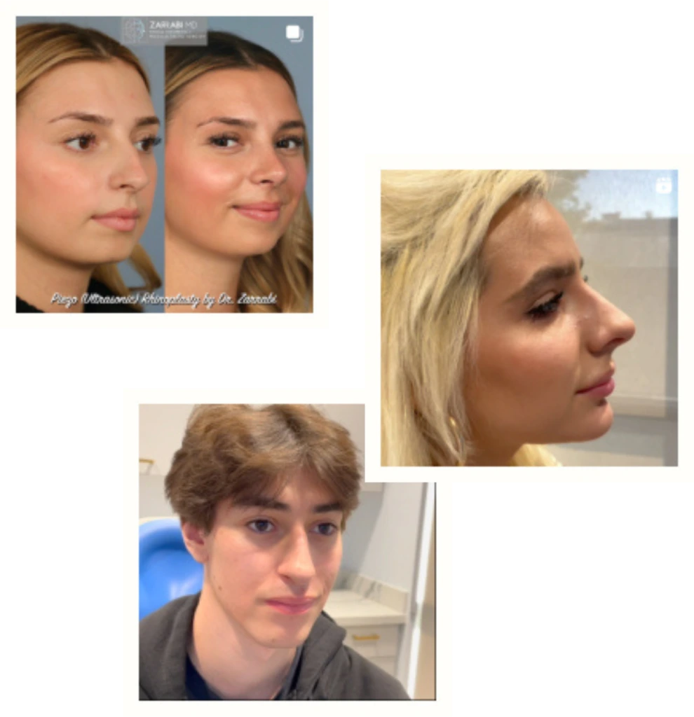 Follow us on Instagram pics