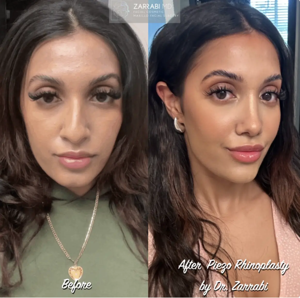 OUR PIEZO ULTRASONIC TECHNOLOGY Banner