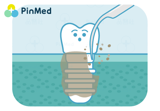 植牙失敗症狀-植體清創