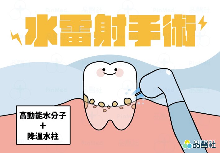 水雷射是什麼?是透過高動能水分子雷射技術