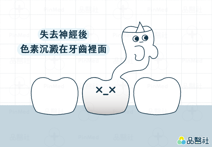 冷光美白_無法改善內因性染色