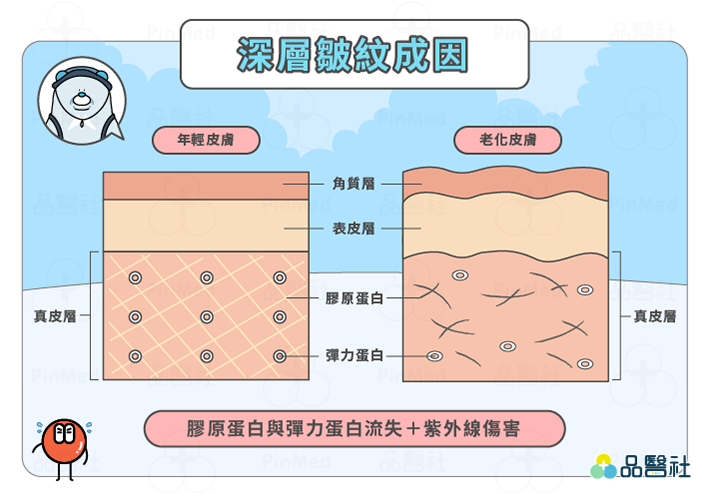 皺紋_深層皺紋/靜態紋成因