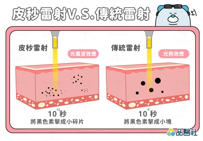 皮秒雷射_皮秒雷射VS傳統雷射