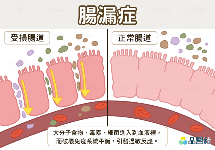 腸胃不好如何改善_腸漏症