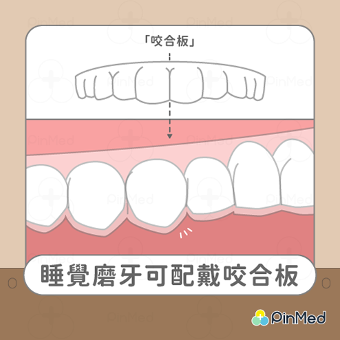 睡覺磨牙_咬合板