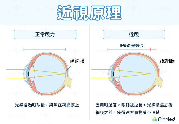 近視_眼睛構造